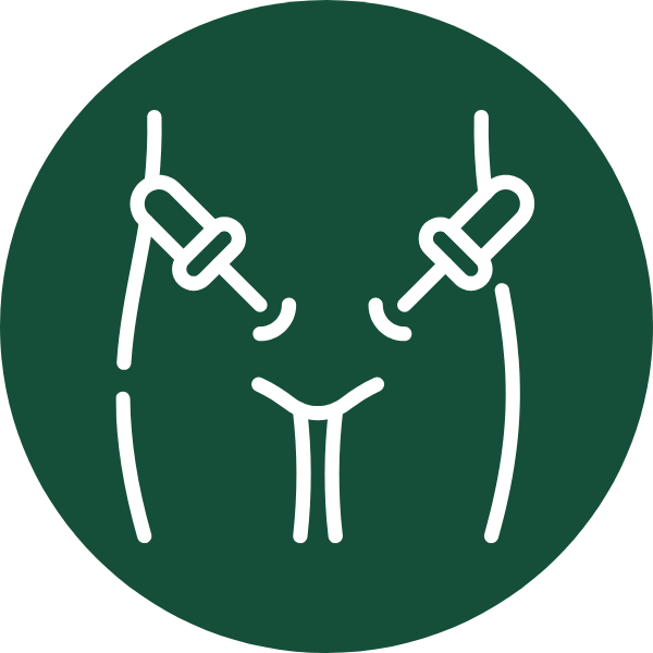 Cirugía Laparoscópica
