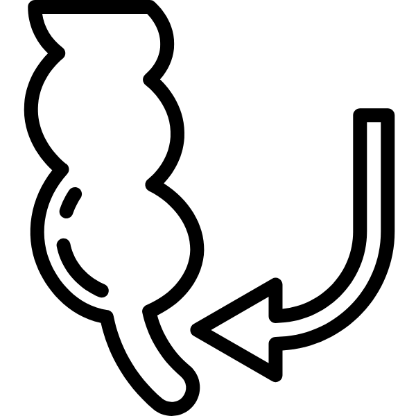 Apendicitis