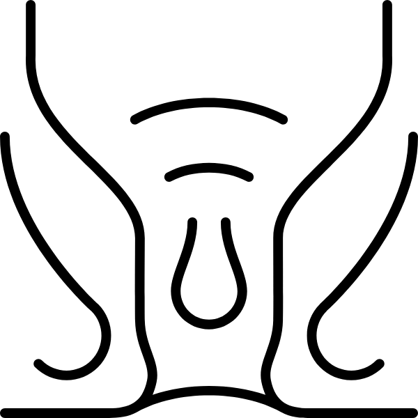 Hemorroidectomia