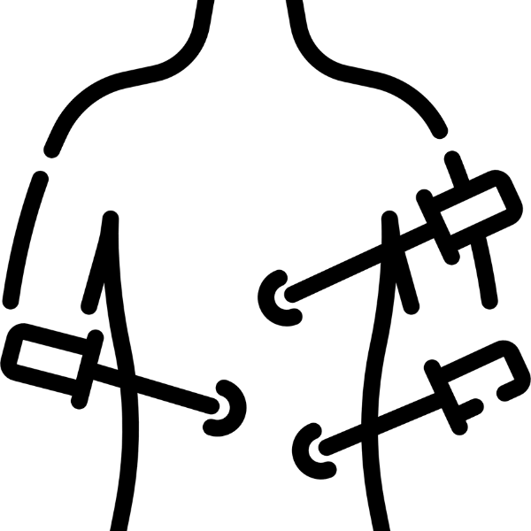 Plastia hiatal laparoscópica