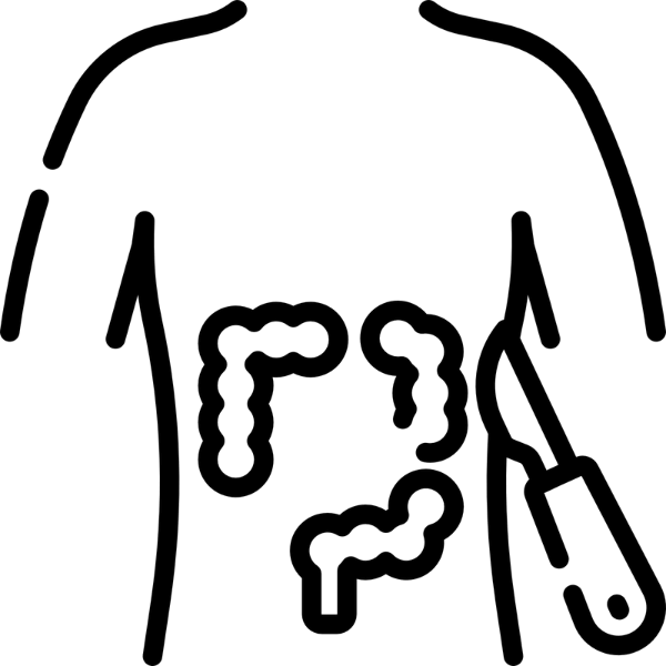Reconexión intestinal